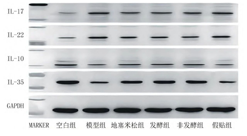 空白組和支氣管哮喘各組大鼠肺組織中IL－17、IL－22、IL－10、IL－35蛋白表達(dá)電泳圖